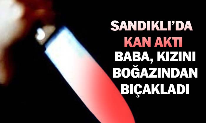 Baba kızını bıçakladı