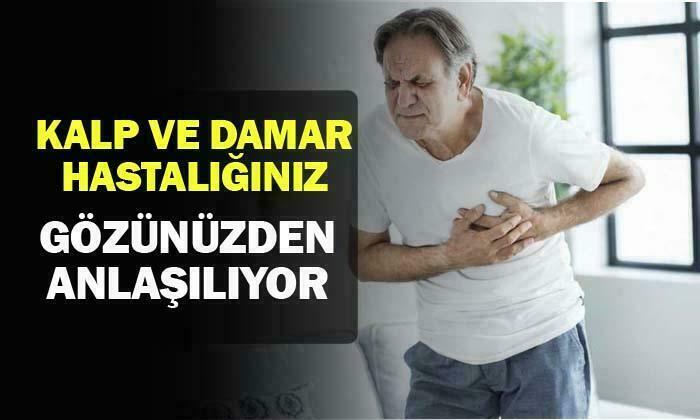 Kalp ve damar hastalıklarınız gözünüzden anlaşılıyor